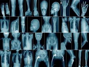 Radiology Telegram Group Links